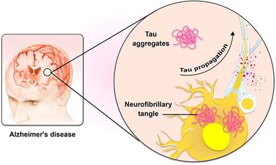 The application of nanotechnology in treatment of Alzheimer’s disease